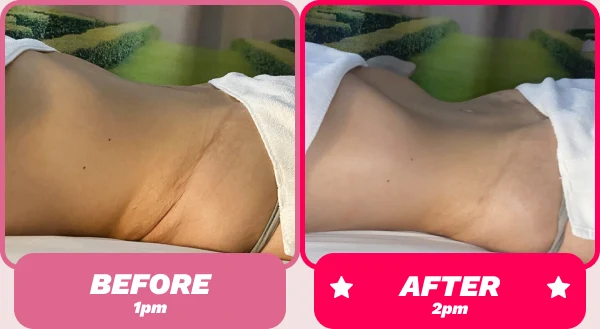 Before and after - Brazilian Body Lymphatic Drainage Massage