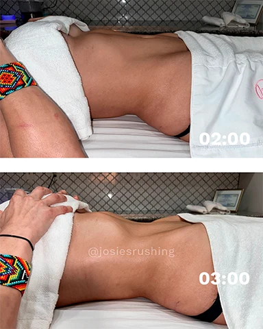 Before and After - Brazilian Body Lymphatic Drainage Massage