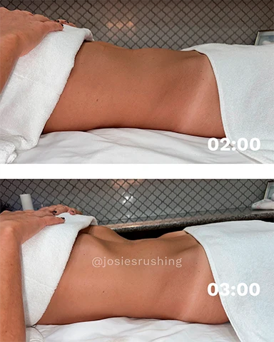 Before and After - Brazilian Body Lymphatic Drainage Massage