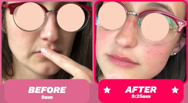 Before and after - Face