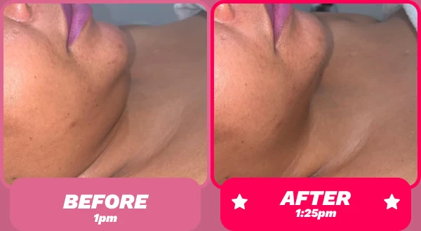 Before and after - Face